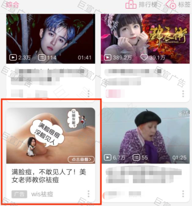 广告展现样式
